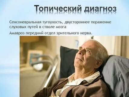 Топический диагноз