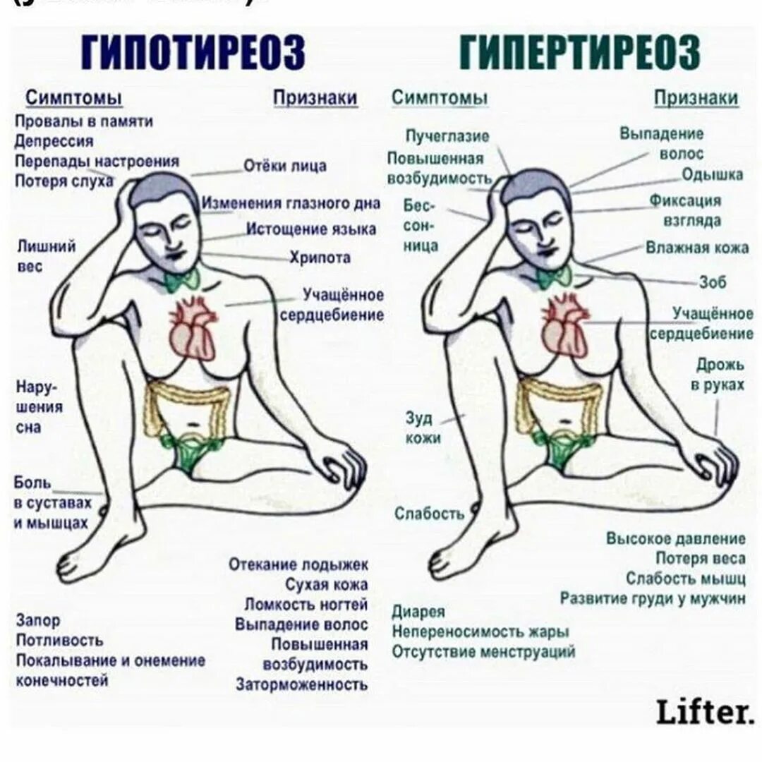 Патогенез гипертиреоза и тиреотоксикоз. Тиреотоксикоз щитовидной железы мужчины. Болезнь щитовидной железы гипертиреоз. Гипертиреоз гормоны щитовидной железы. Тиреотоксикоз щитовидной железы мужчины.