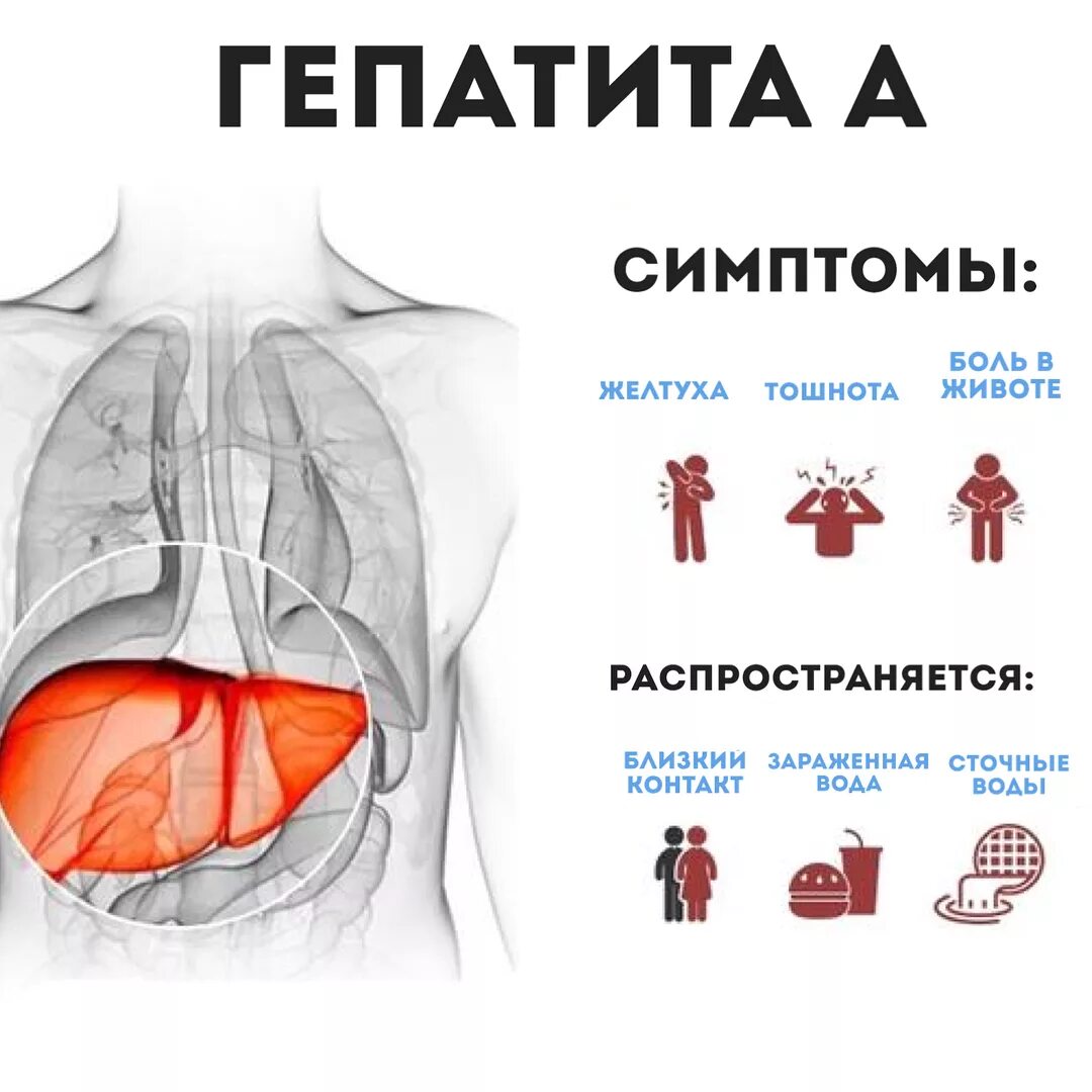 Признаки заболевания гепатитом. Основные проявления гепатита.