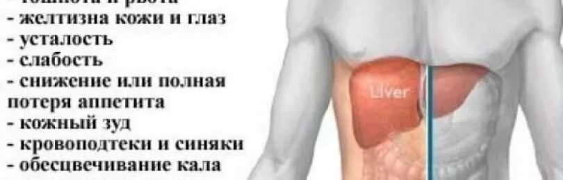 Первые симптомы печени. Живот человека при циррозе печени. цирроз печени симптомы у мужчин. печень у человека болит симптомы.