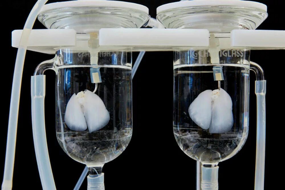 Искусственные органы сердце. Искусственные органы печень. Искусственные органы легкие. Почка из стволовых клеток. Выращенные органы человека.