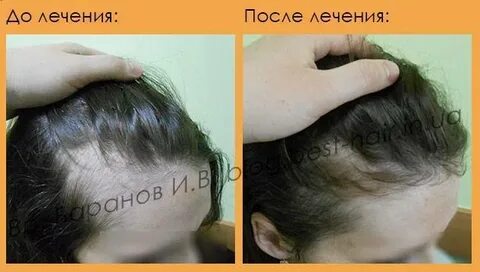 Распущенные волосы во время родов