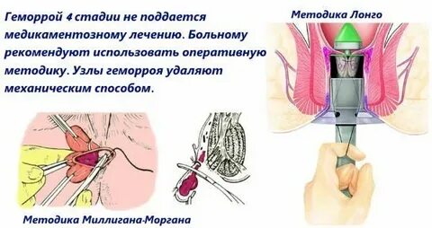 Операция геморроя сколько реабилитация