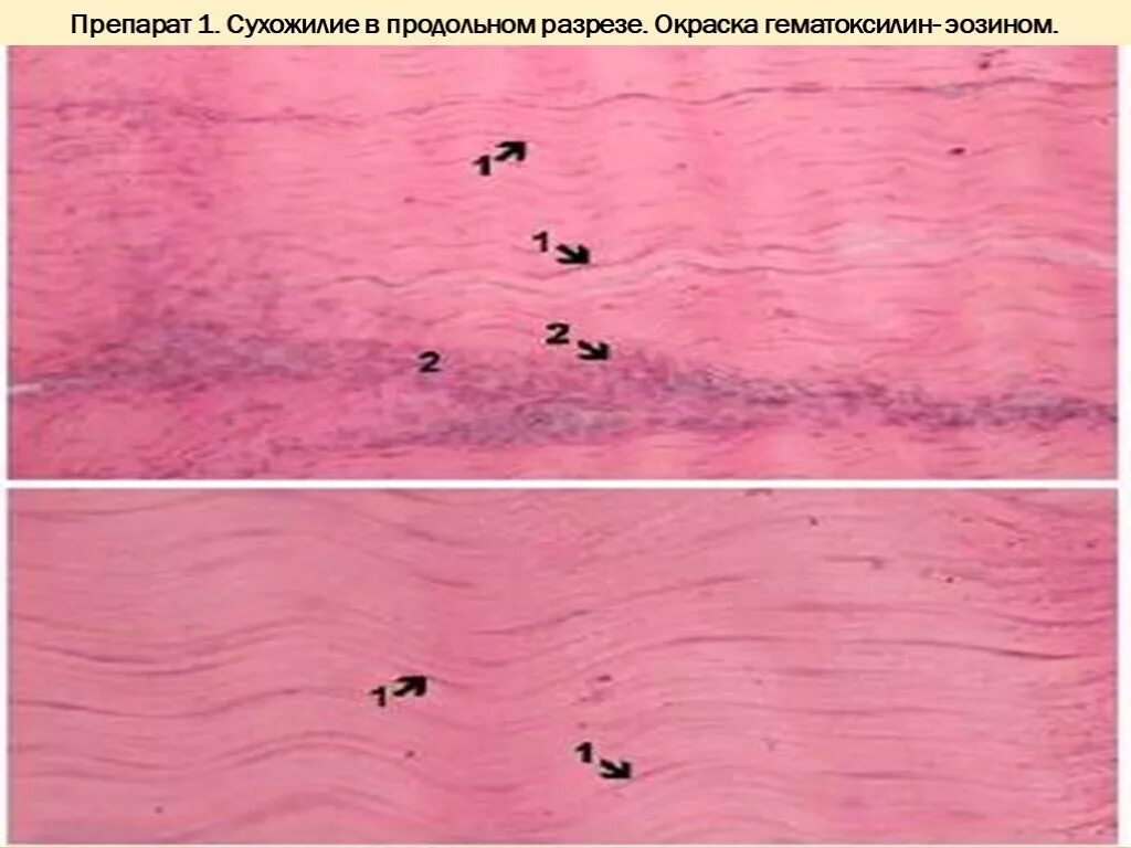 Срез сухожилия. Продольный срез сухожилия препарат. сухожилие свиньи гистология. продольный разрез сухожилия гистология. сухожилие гистология препарат.