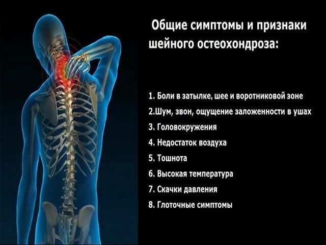 Немеет и болит позвоночник. Обострение шейного остеохондроза. Боли при шейном остеохондрозе. Шейный остеохондроз симптомы. Боль при остеохондрозе грудного отдела.