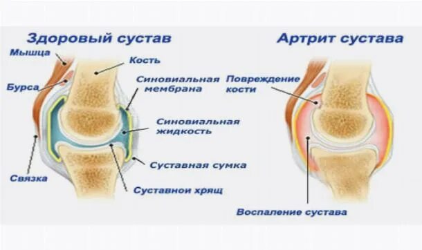 Суставная сумка коленного сустава. Синовиальная мембрана тазобедренного сустава. Синовиальная оболочка голеностопного сустава анатомия. Синовиальная сумка сустава.