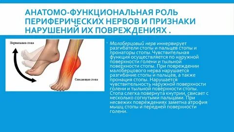 Невралгия малоберцового нерва
