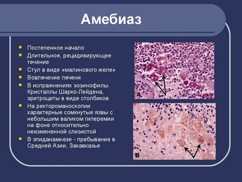 Стадия амебы поражающая толстый кишечник человека. Кристаллы Шарко Лейдена. Острый кишечный амебиаз клиника. Основные формы кишечного амебиаза.