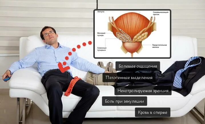 Воспаление семенного мужчин. Воспаление семенных пузырьков. Воспаление семенных пузырьков у мужчин. Семенные пузырьки везикулит. Воспаление семенных пузырьков у мужчин симптомы.