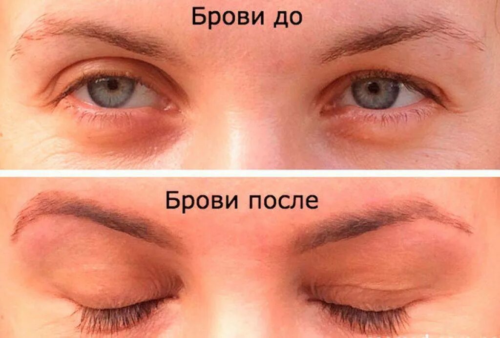 Масло отрастить брови. Касторовое масло для ресниц и бровей до и после. касторка для бровей до и после. касторовое масло для бровей до и после. касторовое масло для ресниц до и после.