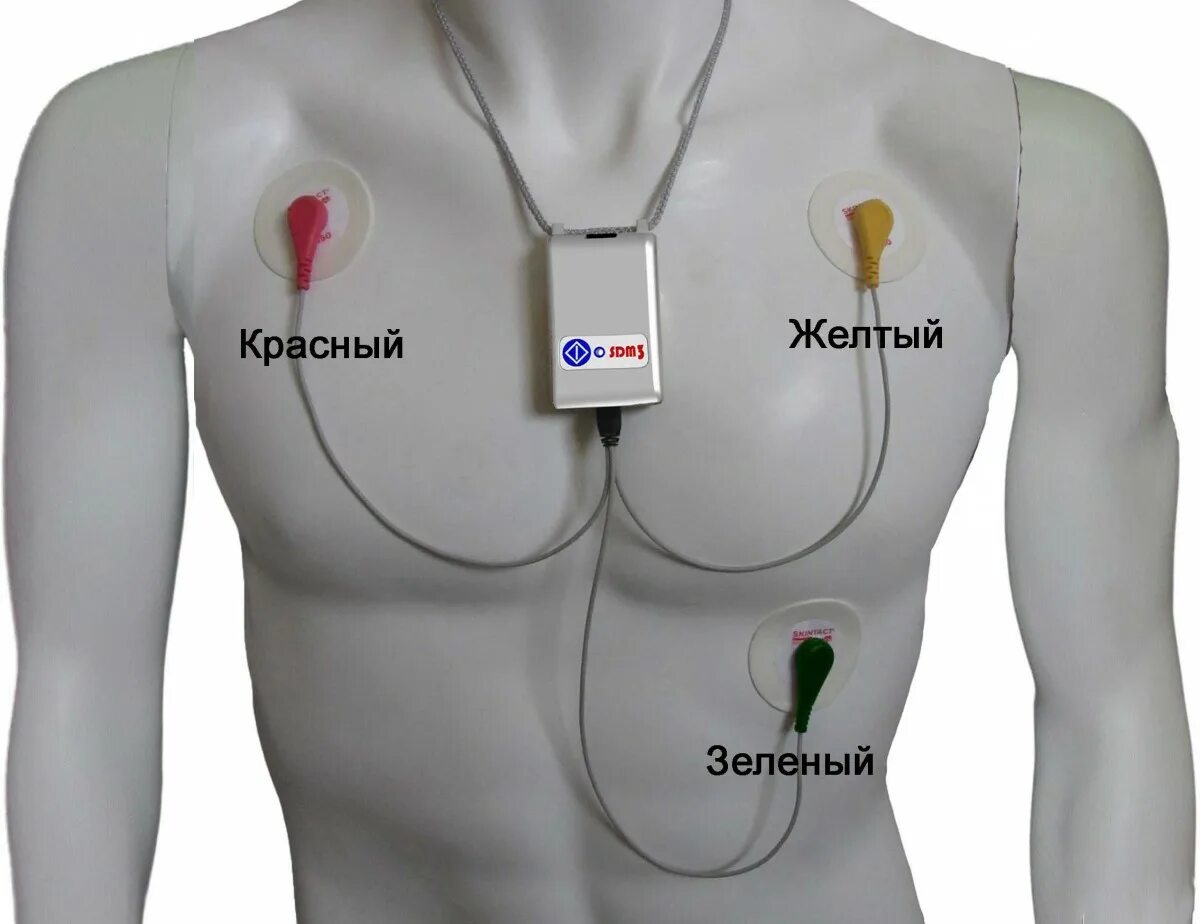 Холтер отведения. Монитор экг 3х канальный наложение электродов. холтер монитор экг. экг 3 отведения холтер. экг монитор датчики 5 электродов.