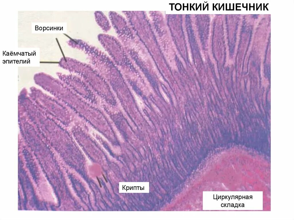 Крипты тонкого кишечника клетки. Клетки эпителия крипт тонкой кишки. Клеточный состав эпителия тонкого кишечника. Эпителиальные клетки кишечника. Камбиальные клетки в тонкой кишке.