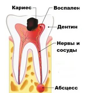 Болит зуб как снять опухоль