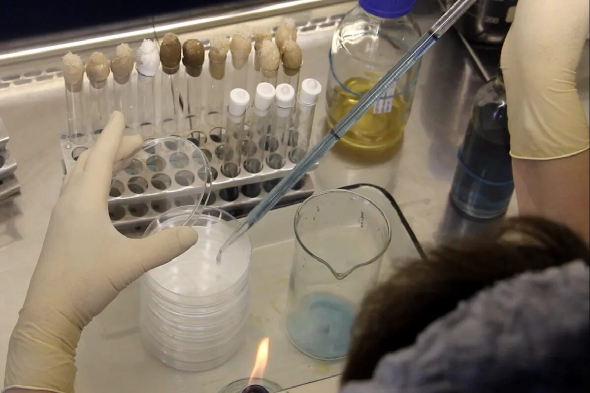 смыв микробиология. микробиологические исследования смывов. санитарно-микробиологические исследования в лпу. бактериологический посев чашка петри. смыв микробиология.