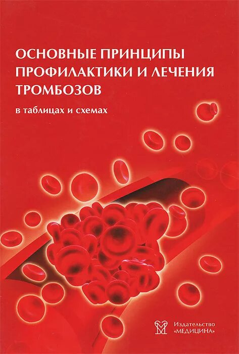 Профилактика лечения тромбов. Кардиология в таблицах и схемах. Основные принципы профилактики. Профилактика тромбоза терапия. Кардиология в таблицах и схемах pdf.