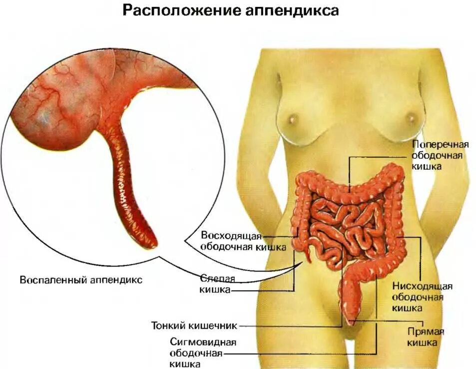 Аппендикс на теле. Расположение аппендикса. Расположение аппендицита. Схема органов человека аппендикс. Расположение аппендикса у человека.