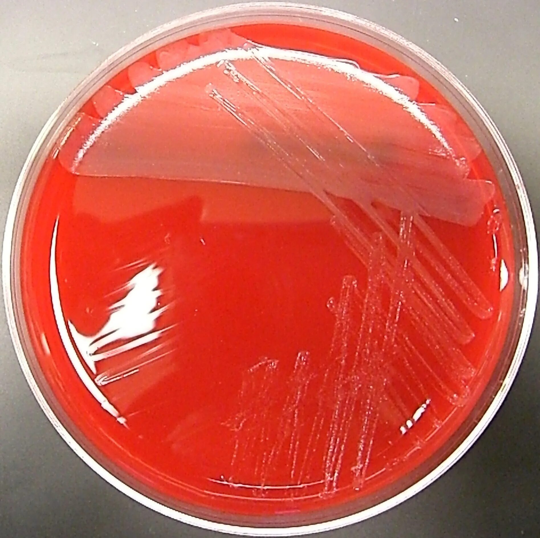 Ба агар. Бордетелла бронхисептика. Bordetella bronchiseptica на кровяном агаре. Bordetella bronchiseptica на агаре. Токсинообразование бордетелл.