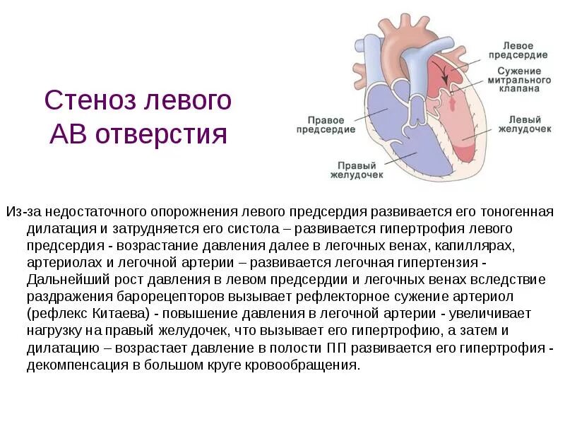 Отверстия левого предсердия. Стеноз левого предсердия. Стеноз правого предсердно-желудочкового отверстия. Гипертрофия левого желудочка при митральном стенозе. Дилатация полостей предсердий