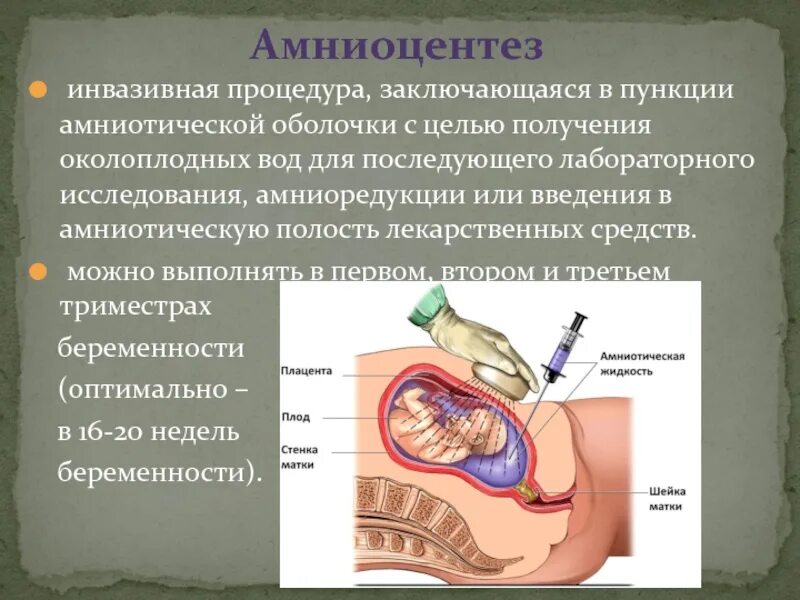 Инвазивные методы исследования. Амниоцентез. Трансцервикальный амниоцентез. Исследование околоплодных вод амниоцентез. Инвазивная пренатальная диагностика амниоцентез.