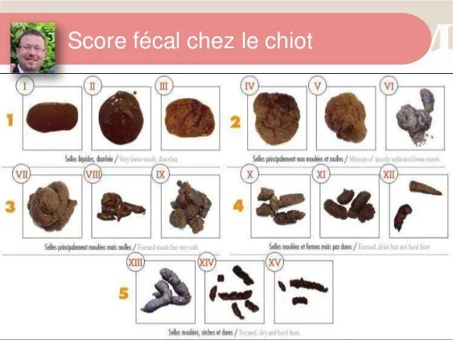 Les selles Alimentation et santé, Selles molles, Selles