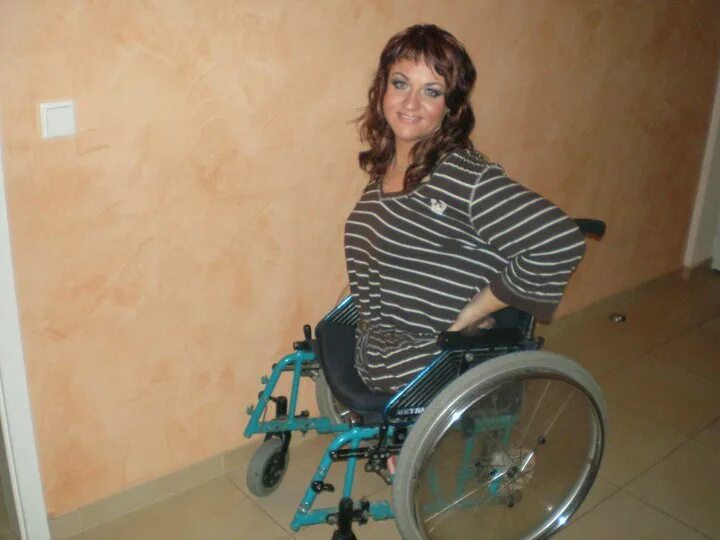 Девушка инвалид. Девочка инвалид. Женщины инвалиды без конечностей. Ампути на коляске. Инвалидка без ног без рук.