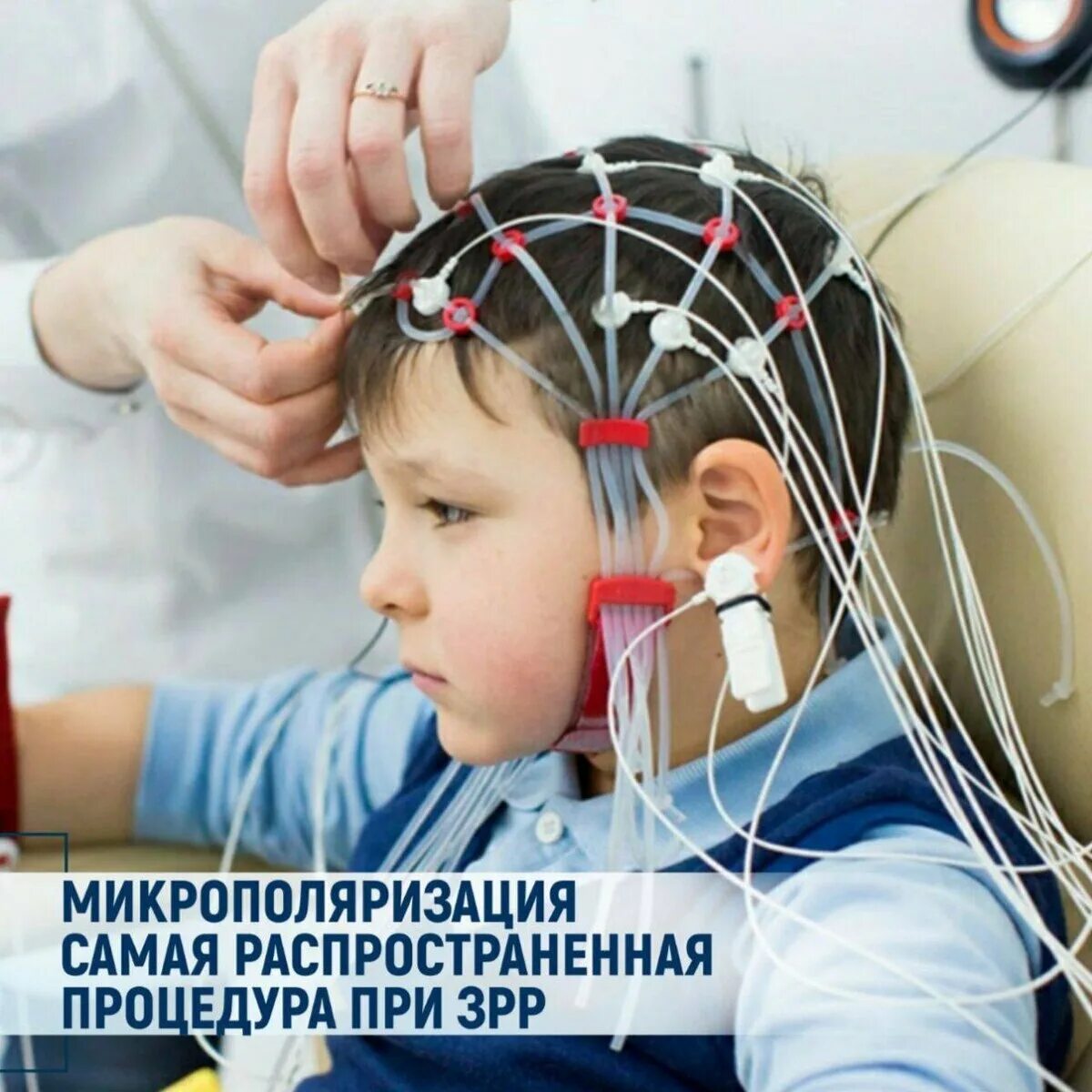 Ээг головного мозга в москве взрослым. Электроэнцефалография головного мозга (ээг). ээг рэг. энцефалограмма головы ребенку. эхо головы.