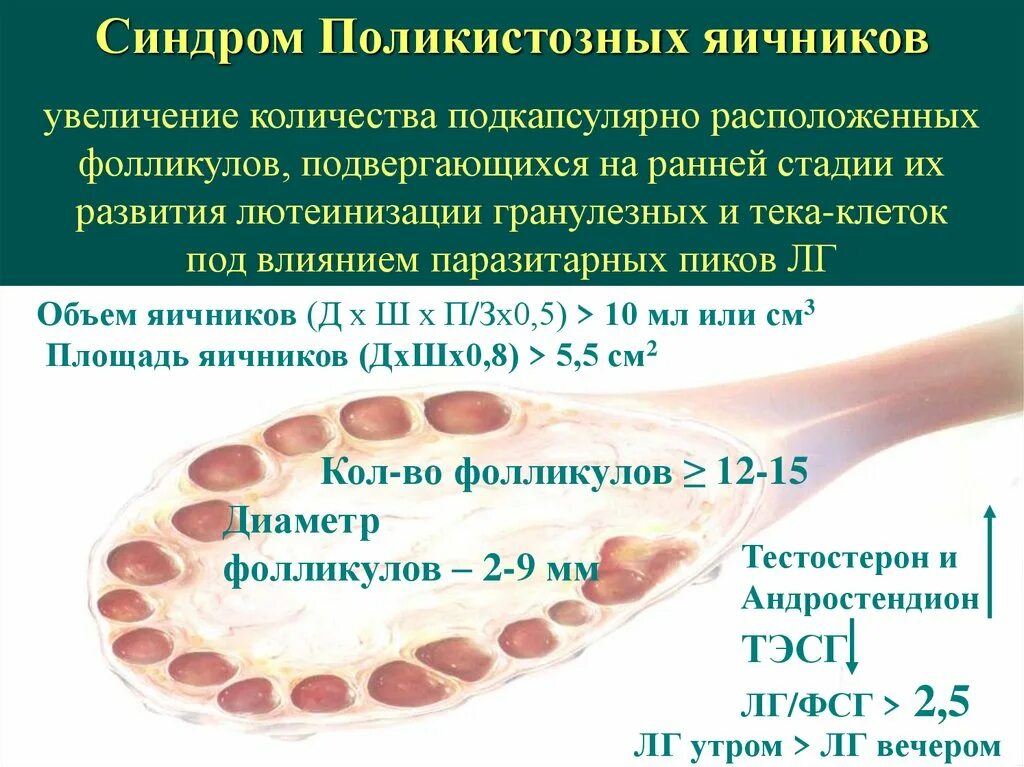 При поликистозе можно забеременеть. Ультразвуковые критерии поликистозных яичников. Синдром поликистозных яичников. Поликистозная структура яичников.