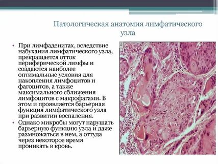 Изменение лимфатического узла