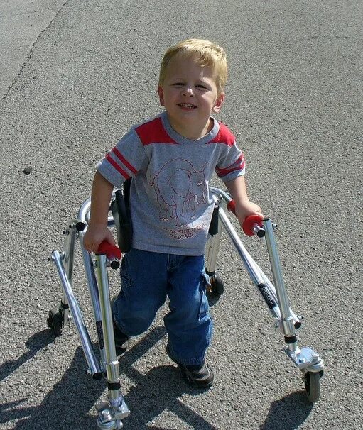 Дети с ДЦП. Детский церебральный паралич тяжелая форма. ДЦП легкая форма. Гемипаретическая форма дцп