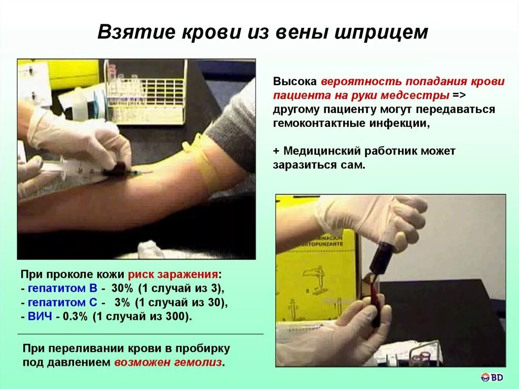 Сколько можно сдавать кровь из вены. Техника взятия крови из вены одноразовым шприцем. Алгоритм забора крови из вены шприцом у ребенка. Забор крови с помощью шприца алгоритм. Кровь из вены с помощью шприца алгоритм.