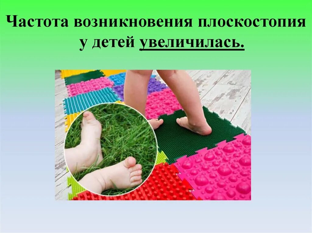 Как исправить плоскостопие у ребенка. Плоскостопие у детей. профилактика плоскостопия у детей. плоскостопие у детей дошкольного возраста. массаж при плоскостопии у детей.