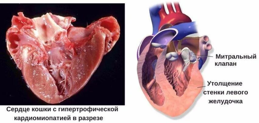 Желудочка сердца расширена. Гипертрофическая кардиомиопатия у кошек. Гипертрофическая кардиомиопатия патогенез. Кардиомиопатия на УЗИ.