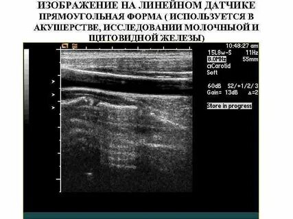 Какие есть узи