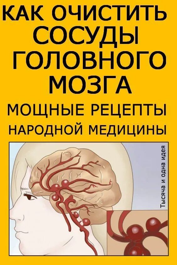 Помочь сосудам головы. Очистка сосудов головного мозга. Очищение сосудов головного мозга и шеи. Очищение кровеносных сосудов и сосудов головного мозга.