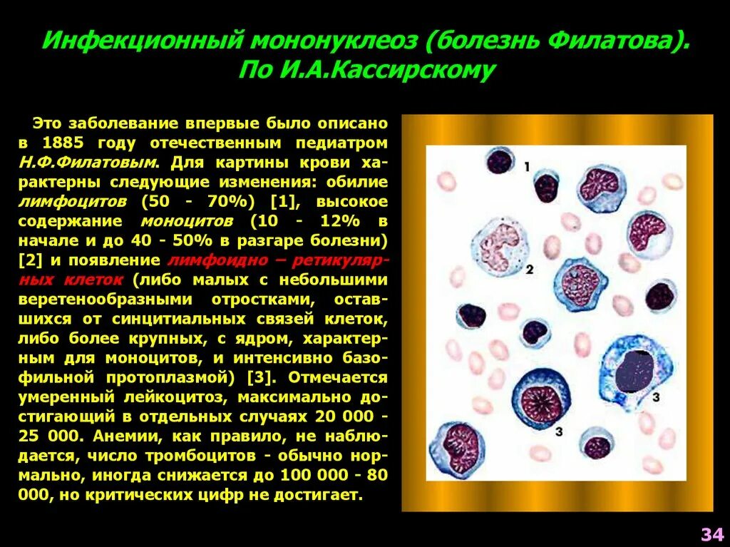 Атипичные мононуклеары картина крови. Мононуклеары микроскопия крови. Инфекционный мононуклеоз мазок крови. Инфекционный мононуклеоз картина крови.