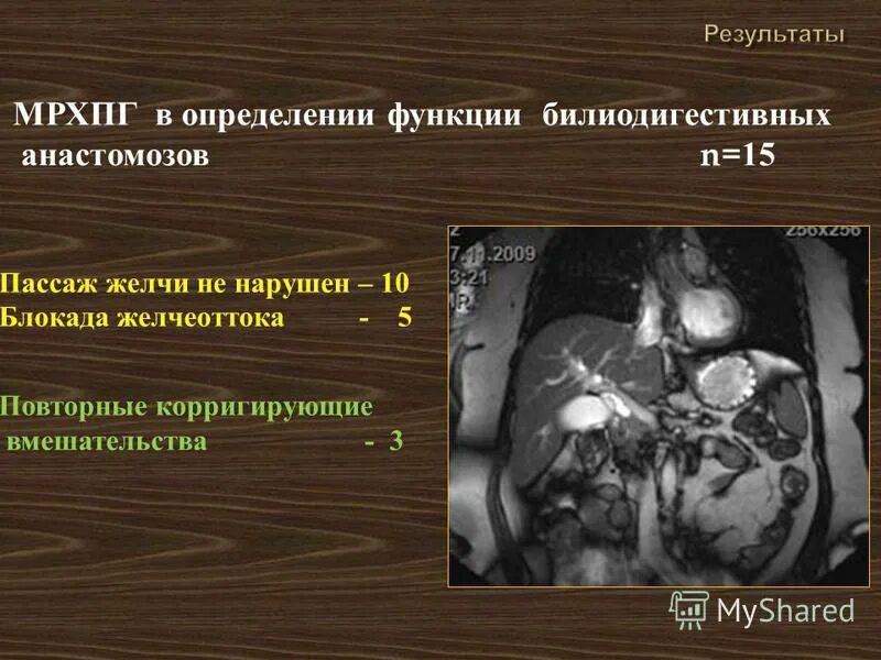 Холангиопанкреатография мрт. Ложе желчного пузыря после холецистэктомии узи. Печеночные протоки мрхпг. Магнитно-резонансная холангиопанкреатография (мрхпг). Сделать мрхпг.