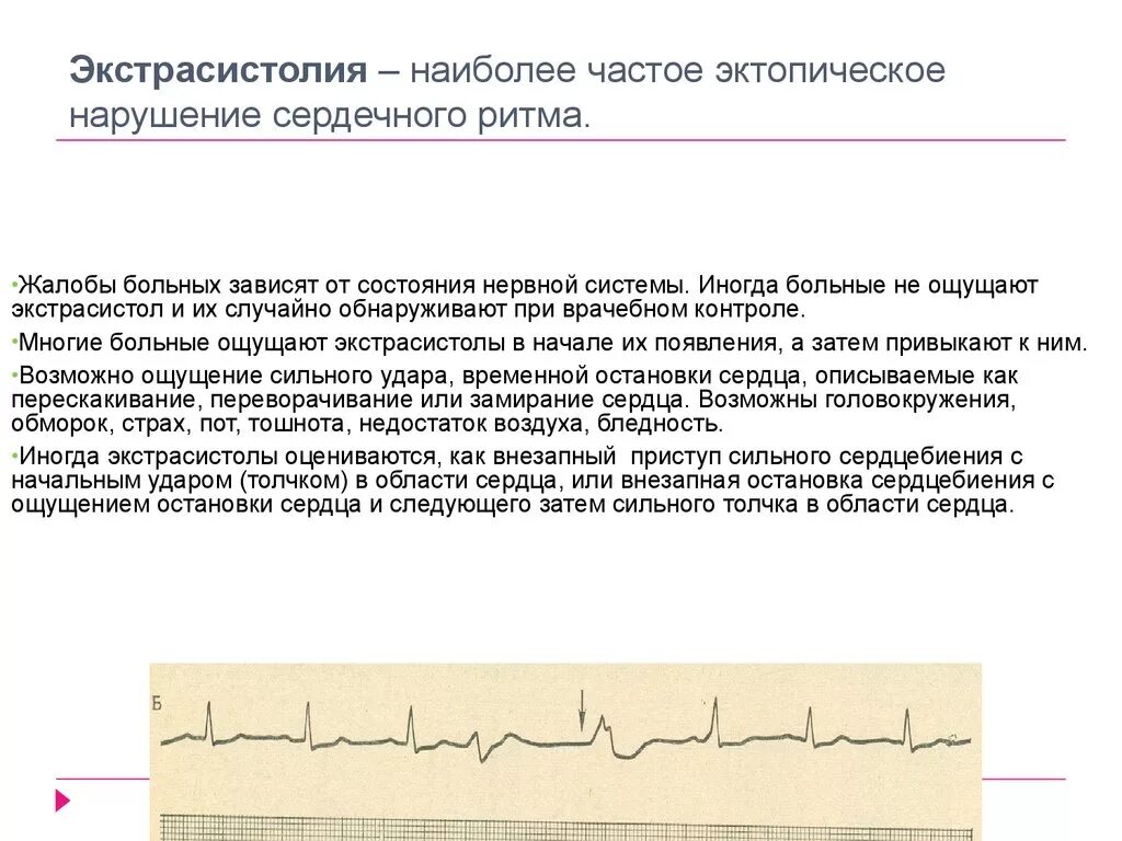 Экстрасистолия нарушение проводимости. Экстрасистолия клиника ЭКГ- признаки. Нарушение сердечного ритма экстрасистолия. Экстрасистолия жалобы. Возникновение экстрасистол