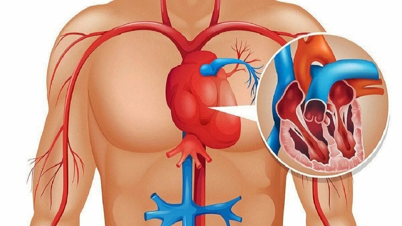 Сердце гонит. Плохое кровообращение. Плохо с сердцем. Сердце больного инфарктом.