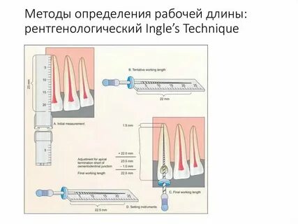 Определение рабочей длины