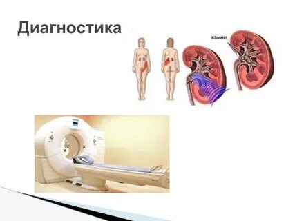 Неотложная урология