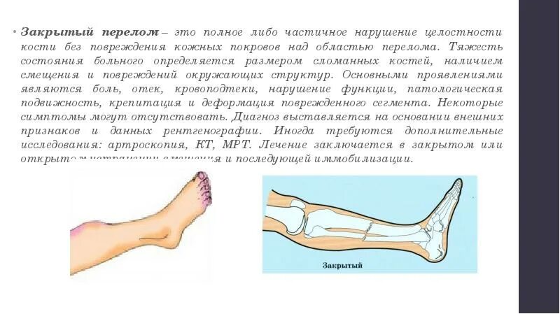 Закрытый перелом голени карта вызова. Перелом ноги открытый и закрытый. Закрытый перелом костей.