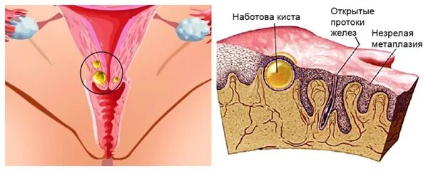 Ихтиоловая мазь при фурункулах: советы и рекомендации к пременению