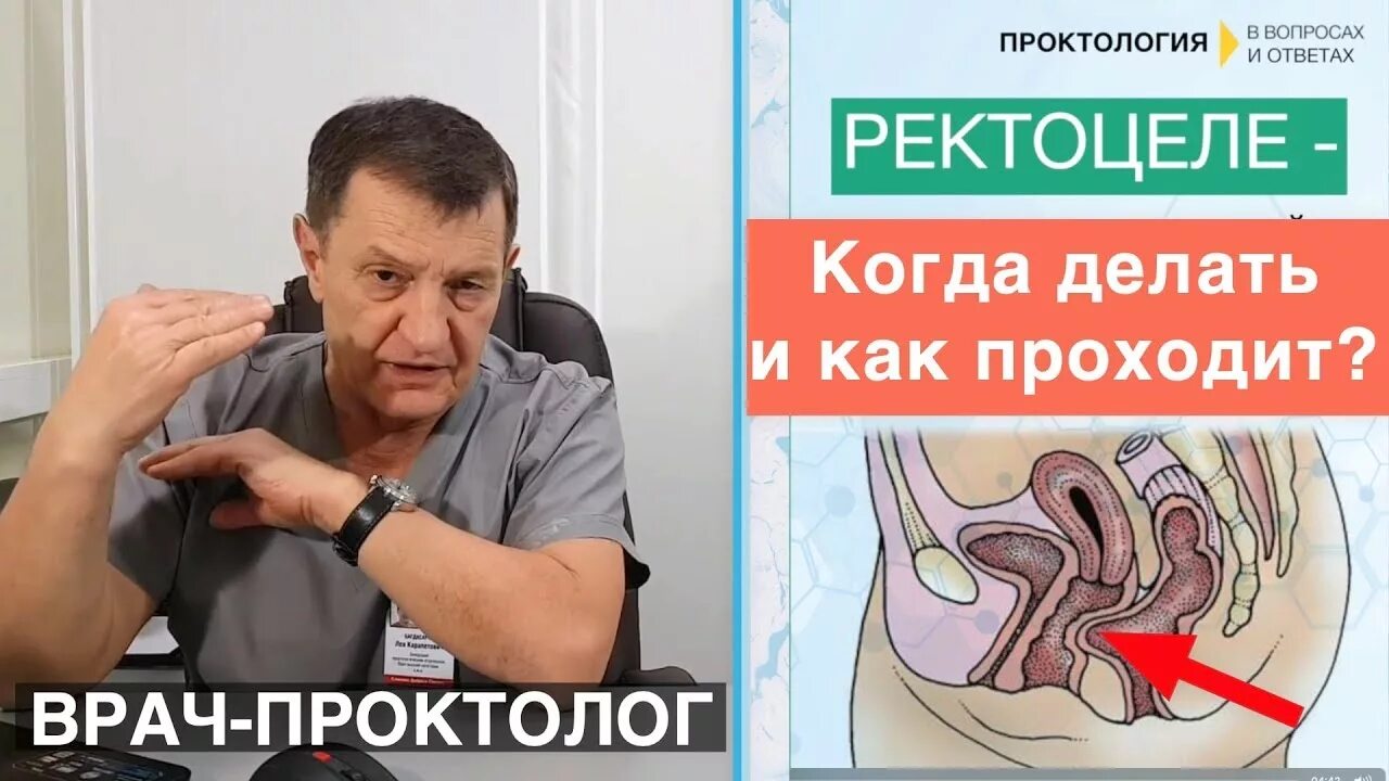 Ректоцеле Фото - Karevaphoto.ru