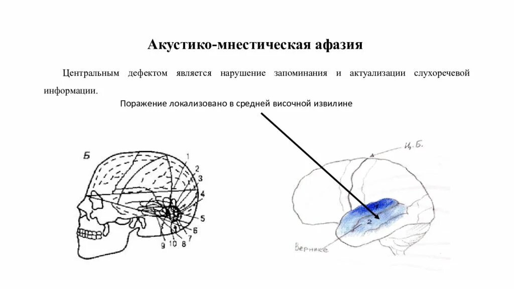 Номинативная функция речи при афазии. Акустико-мнестическая афазия очаг поражения. симптомы акустико-мнестической афазии. локализация поражения при акустико-мнестической афазии. очаг поражения при акустико-мнестической афазии.