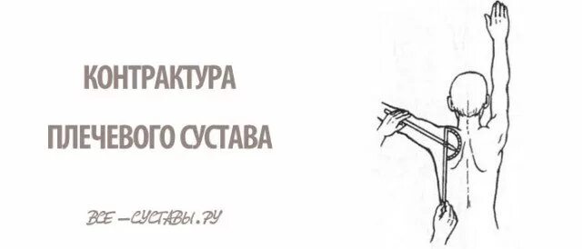 Ограничено движение плеча