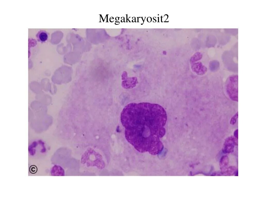 Мегакариоцит цитоплазма. Мегакариоцит гистология. мегакариоцит микроскопия. мегакариобласт. мегакариоциты в костном мозге.