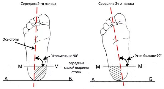 Середина стопы. Подометрия плоскостопия. Оси стопы. Продольная ось стопы. Правильная нагрузка на стопу.