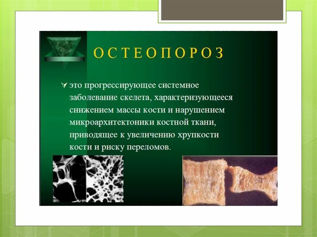 Системное заболевание скелета. Постменопаузальный остеопороз презентация. заболевание скелета характеризующееся снижением массы. микроархитектоника костной ткани это. тки микроархитектоника степени.