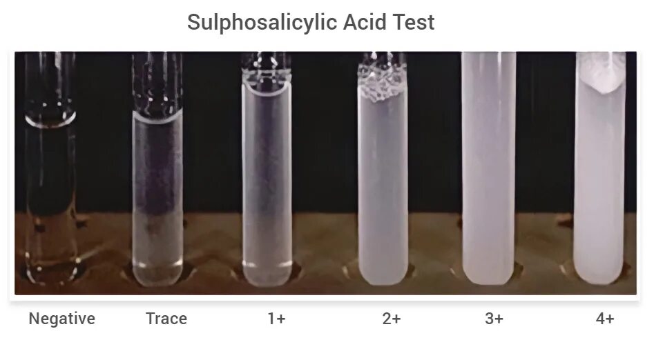 Iv test