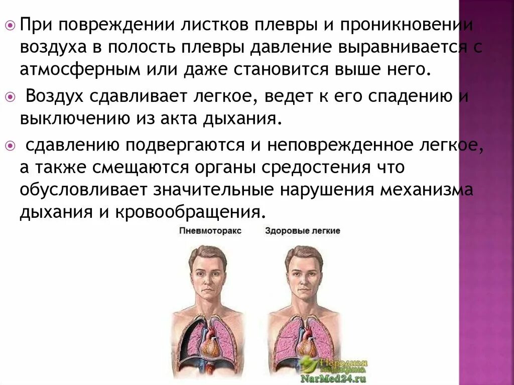 Помощь при открытом пневмотораксе тест